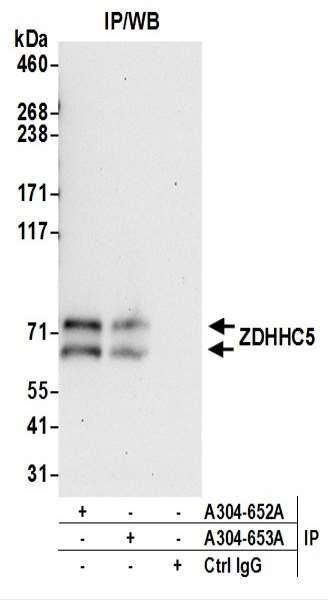 Anti-ZDHHC5