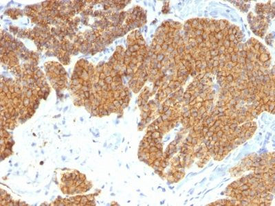 Anti-PTH / Parathyroid Hormone (N-Terminal)(3H9), CF555 conjugate, 0.1mg/mL