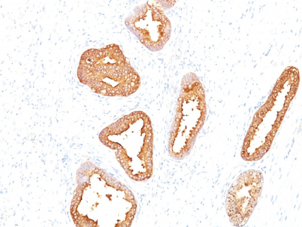 Anti-Prostate Specific Antigen (PSA), clone A67-B/E3