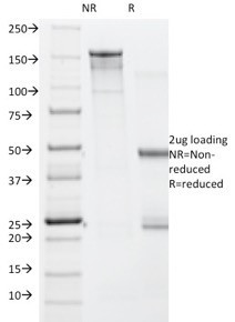 Anti-BRAF (V600E Mutant Specific) (Prognostic Marker), clone V600E/1322
