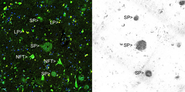 Anti-Amyloid beta, clone AB9