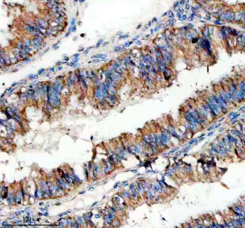 Anti-SIGIRR / Single Ig IL-1-related receptor