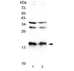 Anti-Neuropeptide S