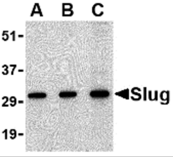 Anti-Slug
