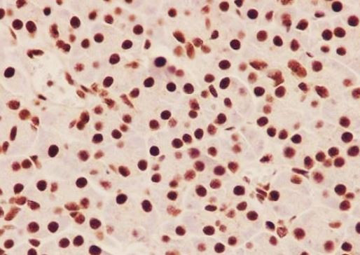 Anti-phospho-SMAD5 (Ser463/465)