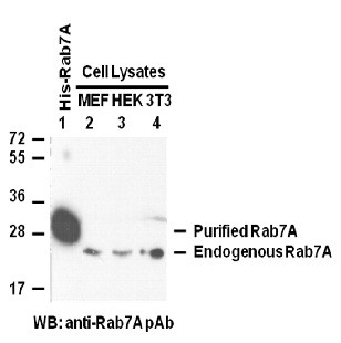 Anti-Rab7A