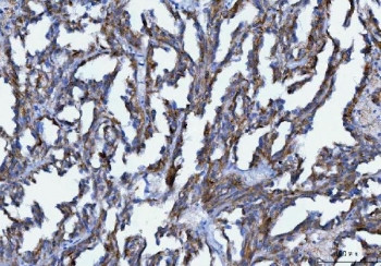 Anti-AXIN2 / Axis inhibition protein 2