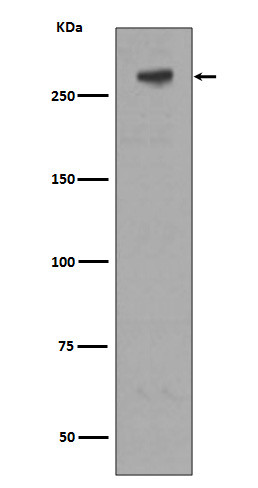 Anti-IGF2R (recombinant antibody)