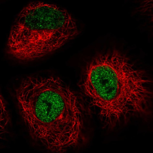 Anti-IRF2BP2