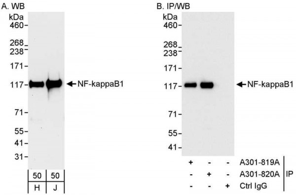 Anti-NF-kappaB1