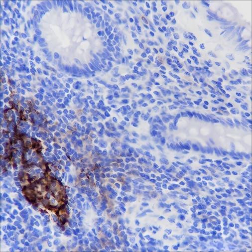 Anti-Recombinant CD35, clone A171