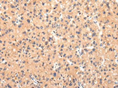 Anti-ATP7B