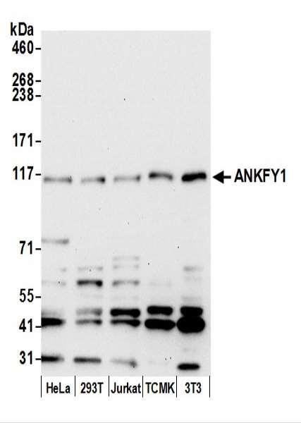Anti-ANKFY1