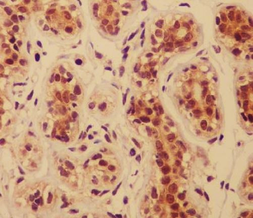 Anti-Cortactin