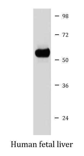 Anti-LPL / Lipoprotein Lipase