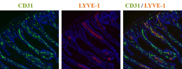 Anti-Lyve1 (mouse)
