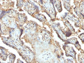 Anti-Galectin-13 (GAL13) / Placental Protein 13 (PP13) Monoclonal Antibody (Clone: PP13/1165)