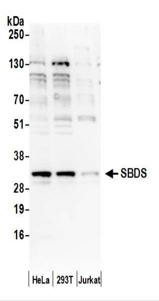 Anti-Shwachman-Bodian-Diamond Syndrome/SBDS