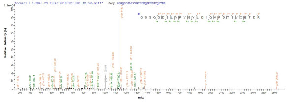 ER membrane protein complex subunit 4 (EMC4), human, recombinant