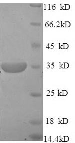 Pituitary homeobox 3 (Pdia2), mouse, recombinant