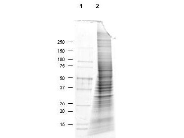 MDA-MB-468 Whole Cell Lysate
