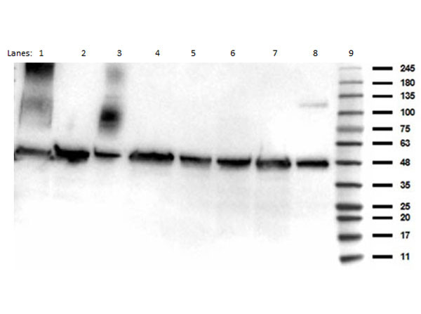 Anti-acetyl-p53 (Lys292)