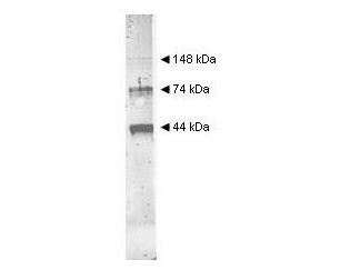 Anti-Alcohol Dehydrogenase (yeast) (ADH)