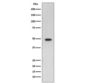 Anti-GFAP / Glial Fibrillary Acidic Protein, clone DBI-7