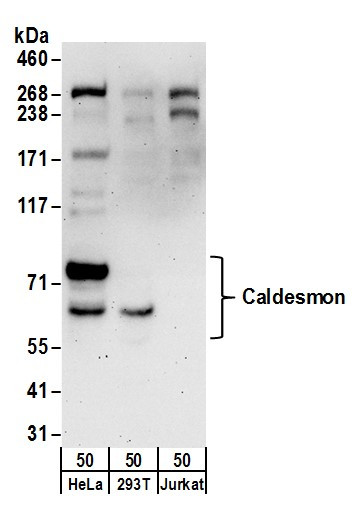 Anti-Caldesmon