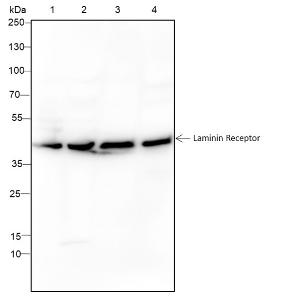 Anti-Recombinant Laminin Receptor, clone A285