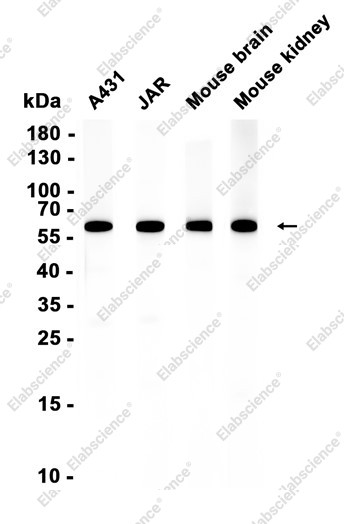 Anti-Recombinant FAAH, clone C222784