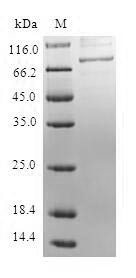 Mannose-6-phosphate isomerase (MPI), human, recombinant