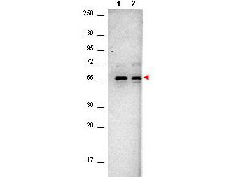 Anti-AKT, clone 18F10.E5