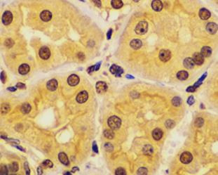 Anti-KPNA6