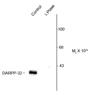 Anti-phospho-DARPP32 (Thr75)