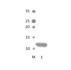 SDCBP2_2 PDZ Domain