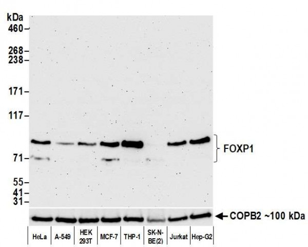 Anti-FOXP1 Recombinant Monoclonal