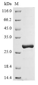 HLA class II histocompatibility antigen, DR beta 5 chain (HLA-DRB5),partial, human, recombinant