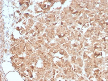 Anti-CELA3B / Elastase 3B, clone CELA3B/2809R