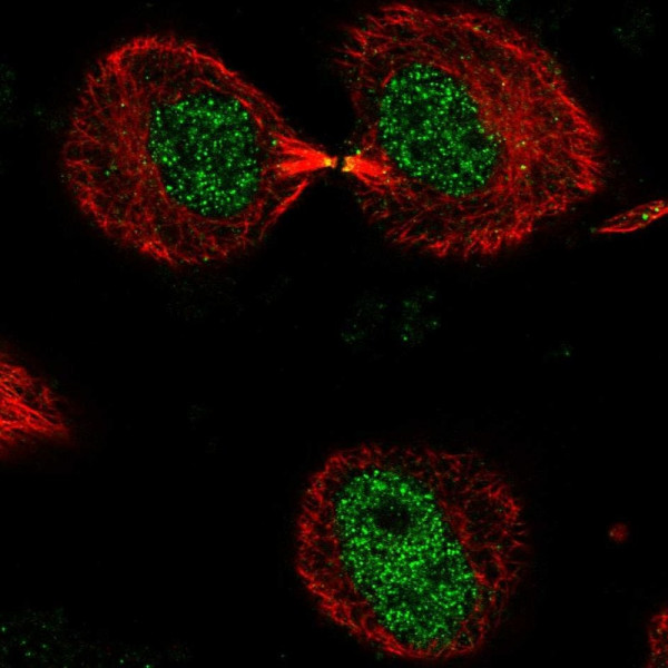 Anti-DNHD1