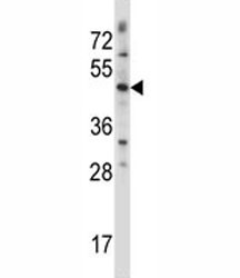 Anti-WNT3