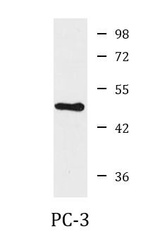 Anti-ATP6AP1