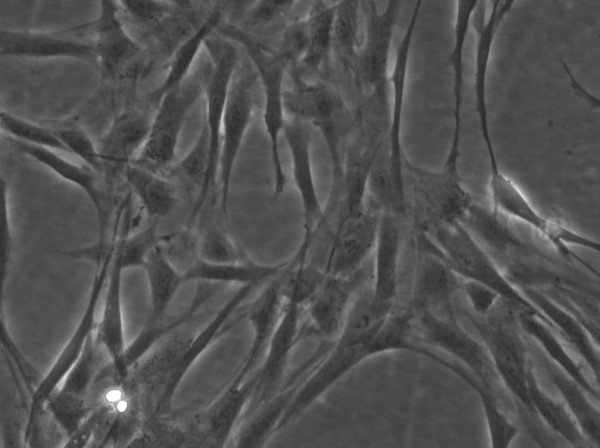 Human Foreskin Fibroblast Cells (HFFC)