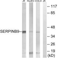 Anti-SERPINB9