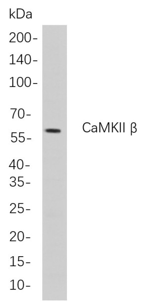 Anti-Recombinant CaMKII beta, clone 6C3