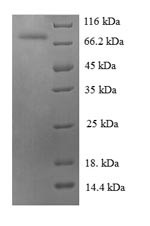 Heat shock 70KDA protein 6 (HSPA6), partial, human, recombinant