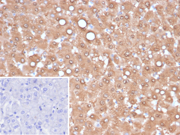 Anti-Arginase 1 (Hepatocellular Carcinoma Marker), recombinant antibody, clone ARG1/6790R
