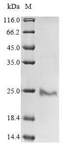 Protein PML (PML), partial, human, recombinant