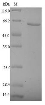 Nuclear receptor subfamily 2 group F member 6 (NR2F6), human, recombinant
