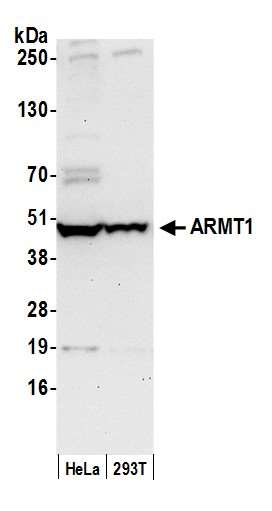 Anti-ARMT1